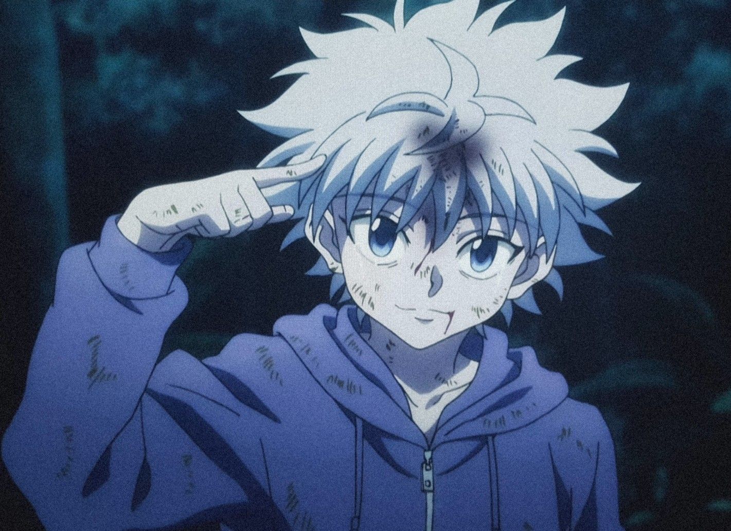 killua pfp aesthetic 0027