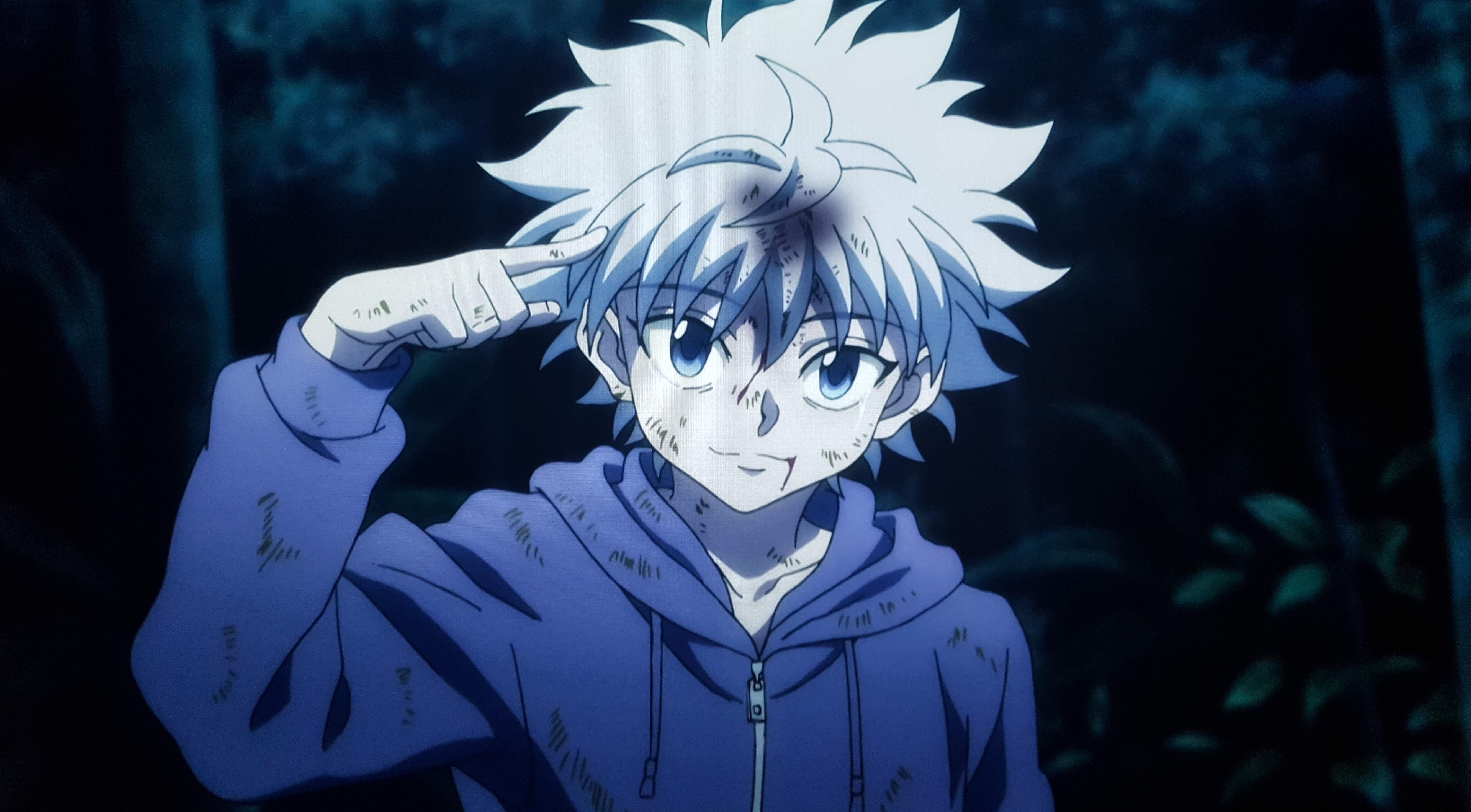 killua pfp aesthetic 0077